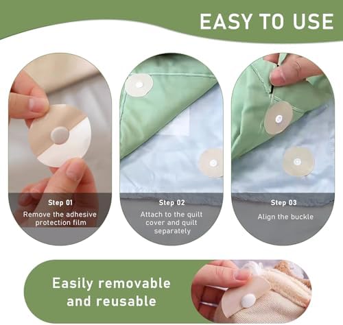 10 Pairs Duvet Snaps for Secure Bedding